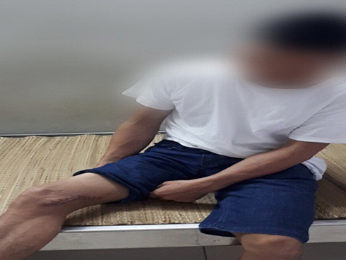 Bệnh Whitmore ăn mòn cơ thể có lây từ người sang người?-2