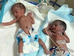 Cặp sinh đôi chào đời cách nhau vài phút nhưng khiến bác sĩ cũng sốc, cả bệnh viện kéo đến chụp ảnh-6