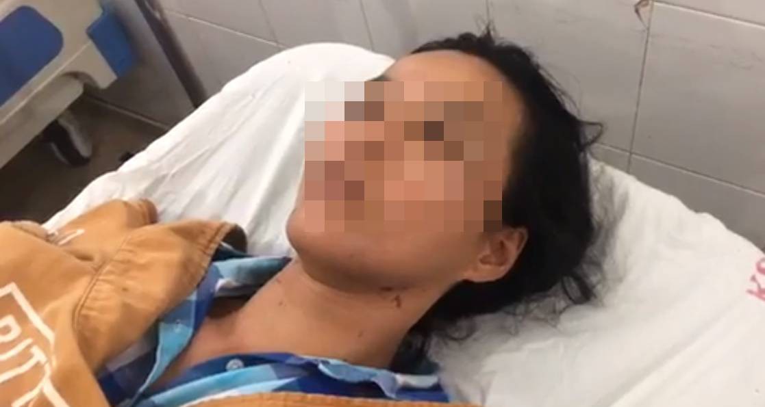 Vụ chồng đánh vợ, dìm xuống hồ bơi trước mặt con nhỏ: Nạn nhân không nhớ nổi số lần bị bạo hành-1