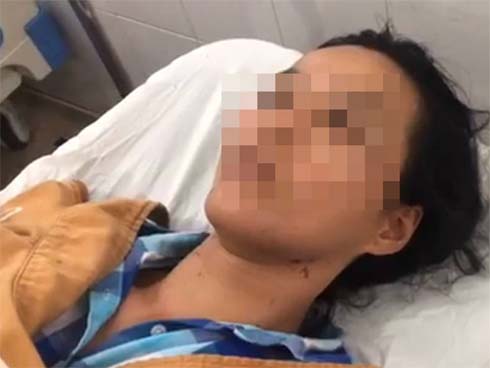 Hé lộ nguyên nhân chồng đánh vợ dã man rồi dìm xuống hồ bơi trước mặt con trai nhỏ-3