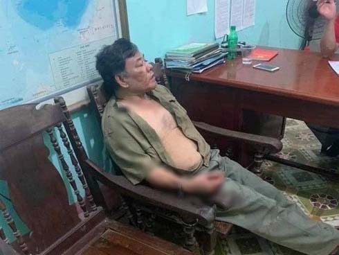 Nạn nhân thứ 2 vụ anh giết cả nhà em gái đã tử vong-3