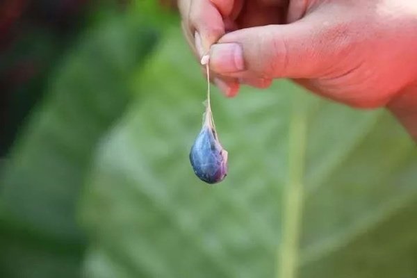 Chàng trai 28 tuổi bị ăn mất não, bác sĩ nói nguyên nhân khiến người cha lập tức hối hận-2