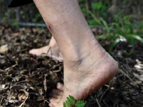 Whitmore xuất hiện ở nhiều tỉnh, những ai dễ mắc bệnh?-3