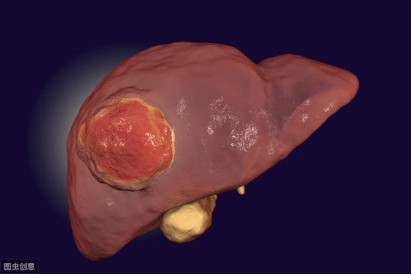 Chỉ vì thường xuyên có cảm xúc tiêu cực với vợ, người đàn ông 44 tuổi này đã mắc bệnh ung thư gan rồi tử vong-2