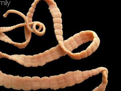 Sán lúc nhúc đầy người vì những món ăn cả triệu người Việt nghiện mê mẩn-4