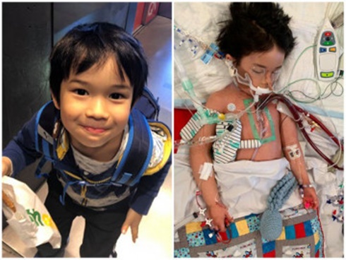 Cậu bé 8 tuổi phải vào viện cấp cứu sau khi được bà nặn mụn trên mũi, cha mẹ cần tránh động tới tam giác tử thần này-3