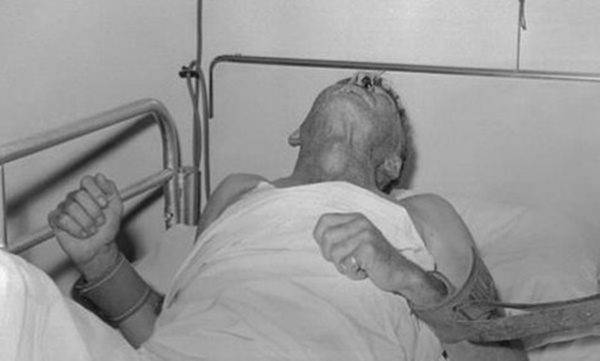 Kém hiểu biết, ông bố trẻ mắc căn bệnh khiến bác sĩ bó tay-1