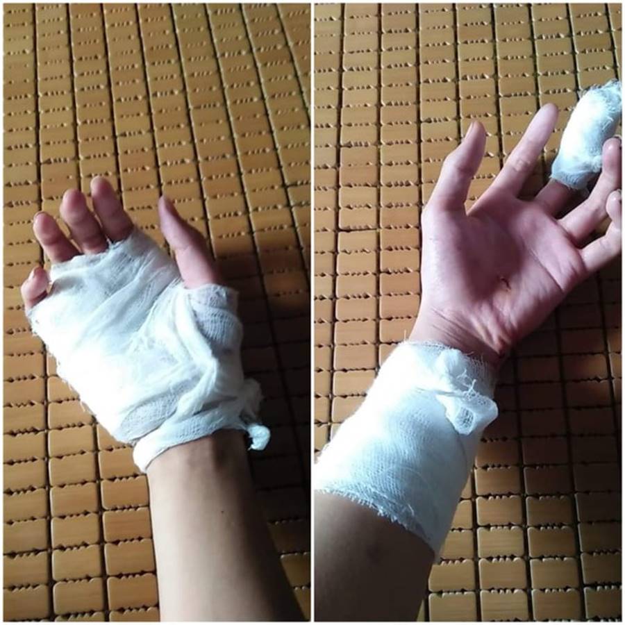 Xô xát trước lớp học, nam sinh phải khâu 30 mũi-2