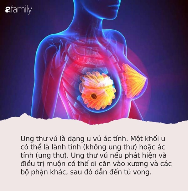 Phát hiện đồ lót của con gái 13 tuổi ra dịch vàng, mẹ dẫn đi siêu âm mới giật mình vì căn bệnh con đang mắc-3