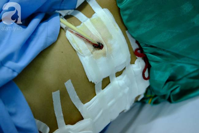Mẹ ôm con út 6 tháng tuổi vào viện chăm con trai lớn bị tai nạn nguy kịch, bật khóc vì không còn tiền để cứu chữa-9