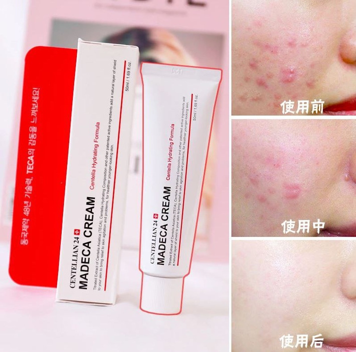 Không khí đang ô nhiễm trầm trọng, chị em cần lưu ý chăm sóc da theo 4 bước này để luôn xinh đẹp-9