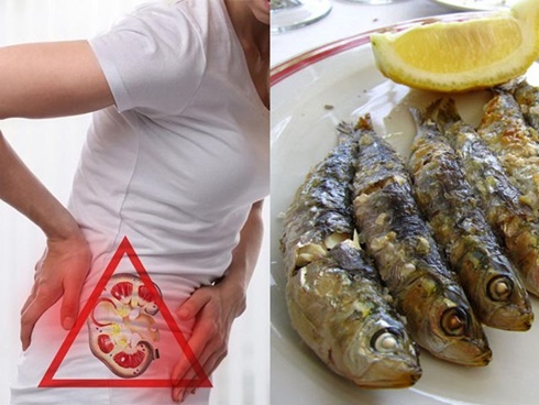 Chuyên gia chỉ rõ 6 thói quen xấu gây sỏi thận người Việt hay mắc phải-3