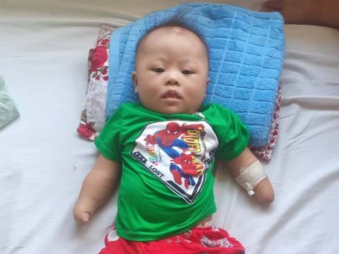Tâm sự đau đớn của người mẹ khi sinh con trai không có 2 tay: 
