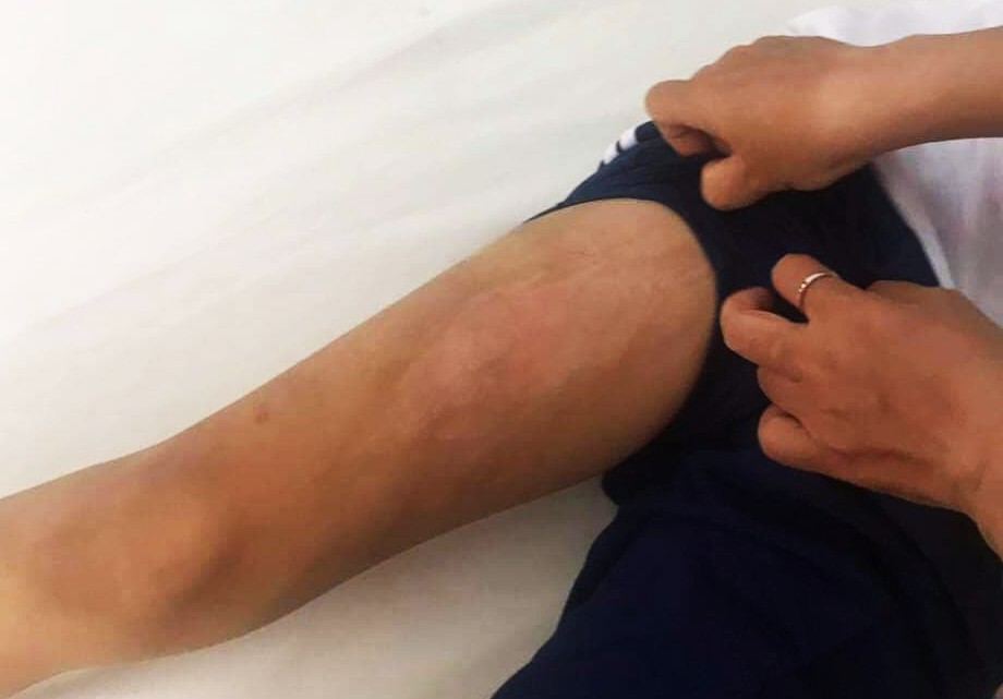 TP.HCM: Nghi án cha ruột bạo hành bé trai 10 tuổi thời gian dài tại chung cư-1