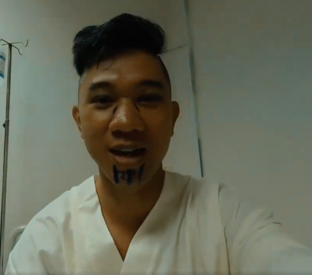 5 màn dao kéo gây sốc nhất lịch sử Vbiz: Người U40 thay đổi đến khó nhận ra, kẻ tự phá danh hiệu mỹ nhân!-1