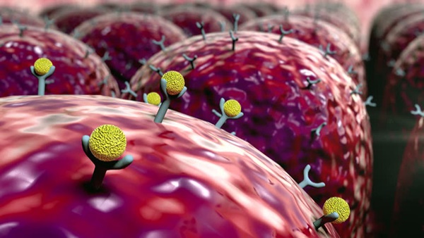 Nam giới sau tuổi 45 phải đặc biệt cảnh giác với 3 căn bệnh nguy hiểm: Biết muộn khó chữa-3