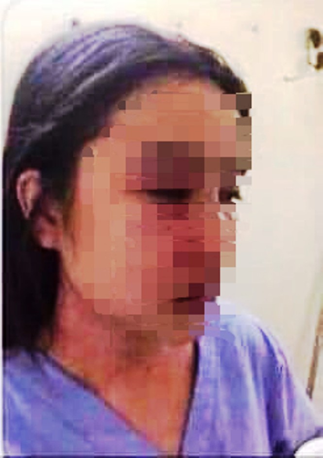 Sức khỏe nữ nhân viên nghi bị bác sĩ Bệnh viện T.Ư Huế hành hung hiện ra sao?-1