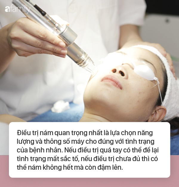 Mặt nát tanh bành chỉ vì ham hố trị nám bằng laser tại spa: Chuyên gia đưa ra cảnh báo ai cũng phải dè chừng-3