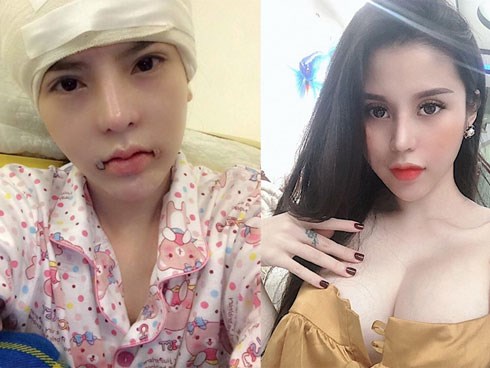 Hai cô gái từng khiến nhiều chị em phụ nữ bị “choáng” khi công khai hình ảnh “đập mặt xây lại” của mình, sau vài năm hiện cuộc sống ai cũng thay đổi đến chóng mặt