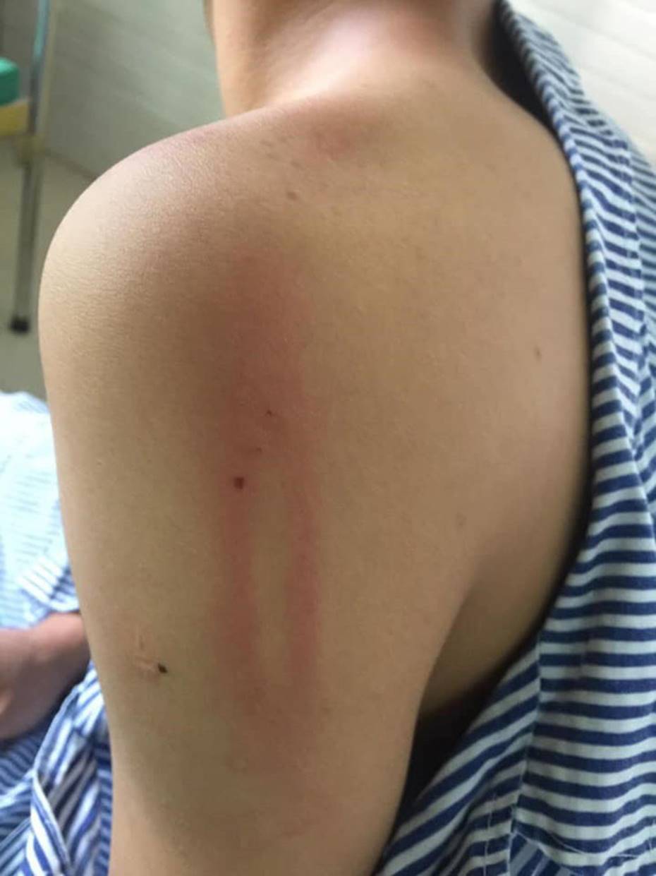 Nam sinh Hà Giang mồ côi cha mẹ bị bạn cùng trường bạo hành chấn động não-2