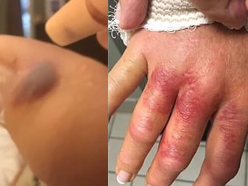 Kinh hãi: Vi khuẩn kháng kháng sinh được tìm thấy trong hầu hết những túi đồ trang điểm của phái đẹp-6