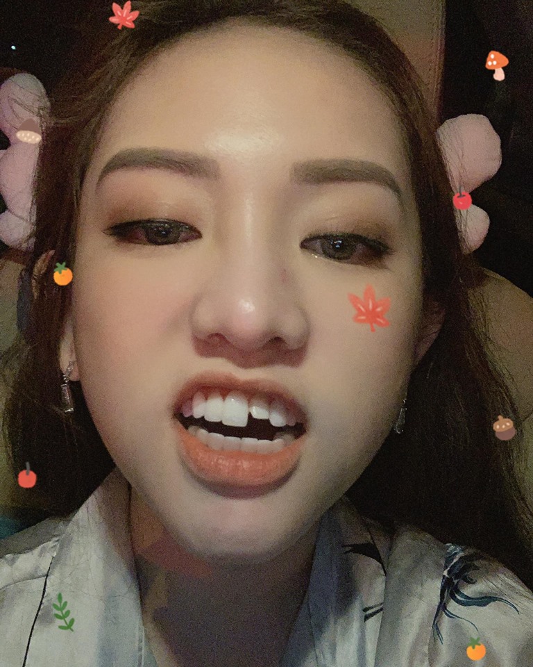 Cười khỏi ngậm miệng xem clip Thúy Vi livestream bán hàng với chiếc răng sún sau cú ngã thế kỷ-1