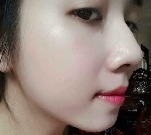 3 loại quả cứ đông đá rồi chà lên mặt là cải lão hoàn đồng, da trắng lại sạch mụn-9