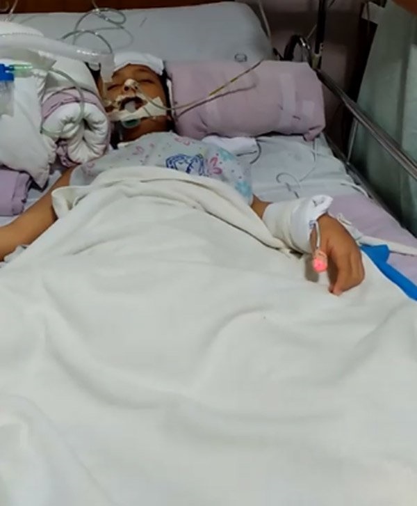 Con trai suýt chết vì một chiếc răng đau, mẹ đau lòng cảnh báo: Hãy dạy trẻ cách đánh răng-1