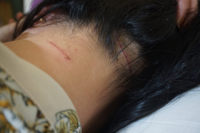 Cựu công an đánh vợ cũ: Nghi vấn ghen tuông-2