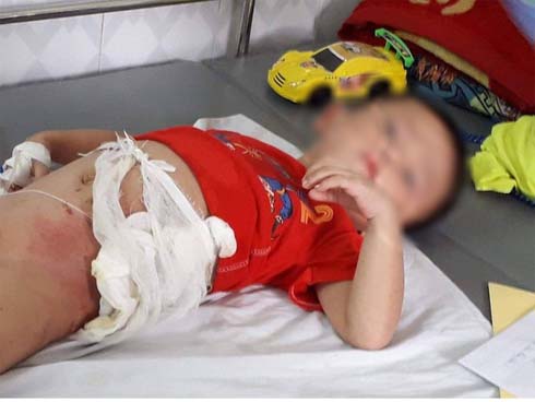 Thông tin sốc về người bác ruột ném cháu vào đống lửa vì tranh ăn dưa-1