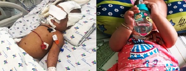 Bé gái 8 tháng tuổi phải mổ não ngay ngày đầu gửi tại nhóm trẻ-1