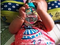 Bé gái 8 tháng tuổi phải mổ não ngay ngày đầu gửi tại nhóm trẻ