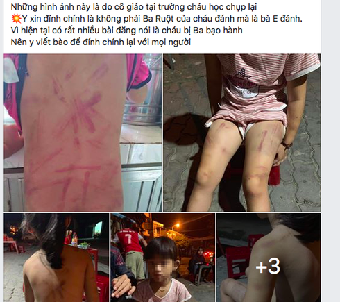 Xôn xao việc bà cố đánh cháu gái 6 tuổi bầm tím người ở Quảng Nam-1