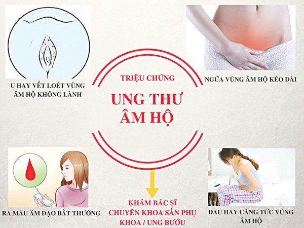 Tưởng chỉ là sợi lông mọc ngược vô hại ở vùng kín, ai ngờ lại là dấu hiệu của bệnh ung thư hiếm gặp-6