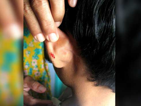 Nam sinh tử vong sau khi bị phạt chạy bộ vòng quanh sân trường-2