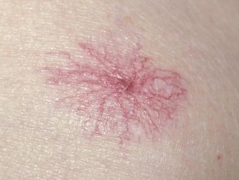 5 tín hiệu ít ai ngờ báo hiệu bạn cần đến bệnh viện ngay