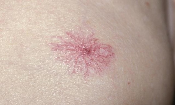 5 tín hiệu ít ai ngờ báo hiệu bạn cần đến bệnh viện ngay-5