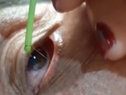 Ba mẹ con bị ngứa râm ran khắp người, đi khám phát hiện cùng mắc chung một loại bệnh-2