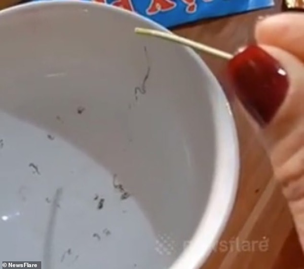 Video gắp đống giun trong mắt người phụ nữ Cao Bằng lên báo Tây-2