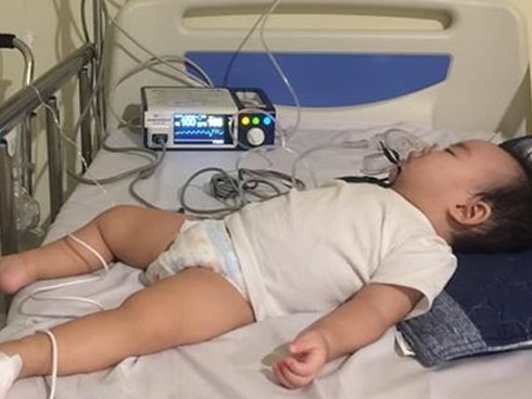 Viêm phổi là một trong những nguyên nhân gây tử vong ở trẻ em: Bệnh viêm phổi ở trẻ có lây không? Cách chăm trẻ bị viêm phổi sao cho đúng-6