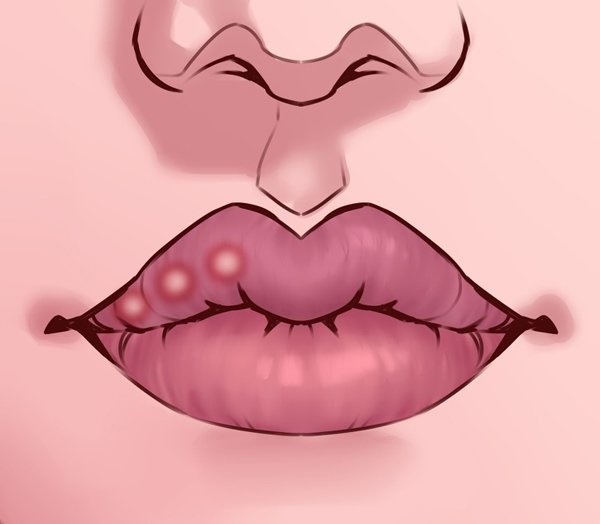 8 dấu hiệu ở môi nhất định phải lưu ý, đặc biệt điều cuối rất nguy hiểm nên khám ngay-3