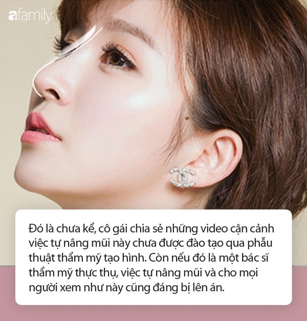Có thể tự nâng mũi hay không: Chuyên gia đưa ra giải đáp khiến ai cũng kinh ngạc-2