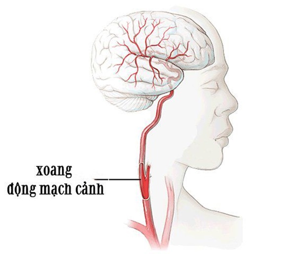 Đừng dại hôn vào 2 khu vực cấm kị này trên cơ thể, đã có người thiệt mạng vì nó-2