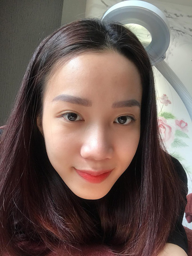 1 năm bị mụn chi chít, 3 tháng sau da mặt cô nàng này láng căng nhờ cách chăm sóc cực đơn giản-2