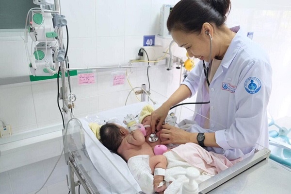 Cặp song sinh dính liền chung 1 lá gan được phẫu thuật tách rời-1