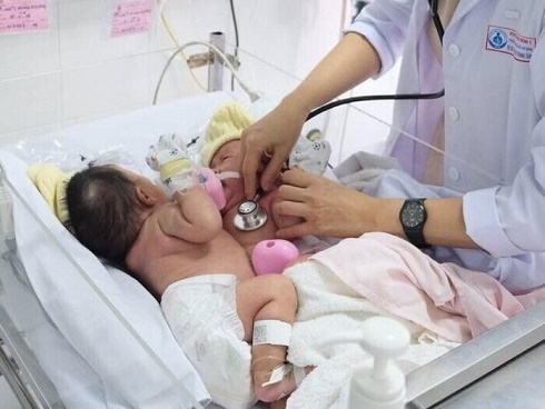 Nữ bệnh nhân bốc cháy dữ dội ngay trên bàn mổ-2