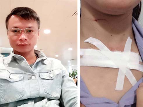 Cha nghi lên cơn ngáo đá, dùng dao đâm liên tiếp con trai 9 tuổi đến vỡ lách vì tưởng là... chó-3