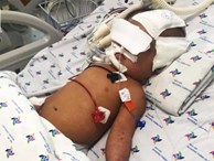 Vụ bé gái 8 tháng tuổi nghi xuất huyết não ngay ngày đầu đi nhà trẻ: Giám định bé bị thương tật đến 84%