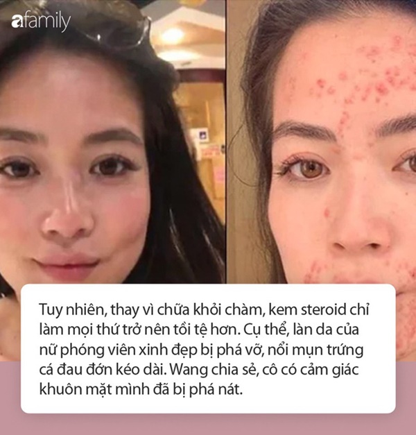 Từ một cô gái có làn da trắng mịn hồng hào, nữ phóng viên mắc chứng bệnh với mụn nổi khắp miệng ai cũng phát sợ-1