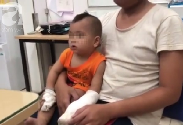 Tai nạn kinh hoàng: Người nhà thử xe máy mới mua, bé trai 1 tuổi bị đứt lìa 4 ngón tay-3